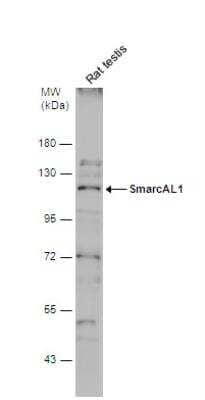 Western Blot: SmarcAL1 Antibody [NBP2-20414]