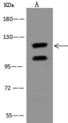 Western Blot: SmarcAL1 Antibody [NBP3-12599]