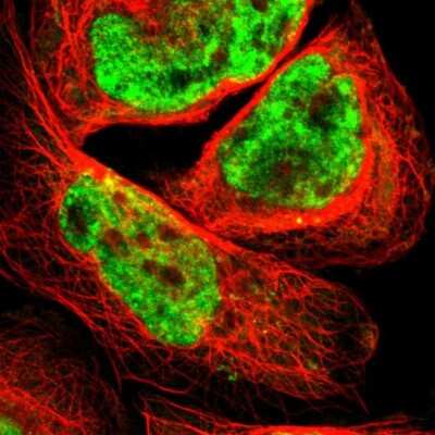 Immunocytochemistry/ Immunofluorescence: Smek1 Antibody [NBP1-84664]