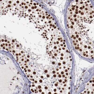 Immunohistochemistry-Paraffin: Smek1 Antibody [NBP1-84664]