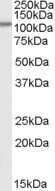 Western Blot: Smek1 Antibody [NB100-68163]