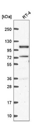 Western Blot: Smek1 Antibody [NBP2-56478]