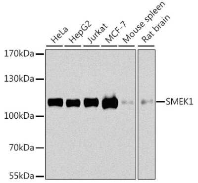 Western Blot: Smek1 AntibodyBSA Free [NBP2-94709]