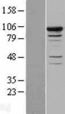 Western Blot: Smek1 Overexpression Lysate [NBL1-16241]