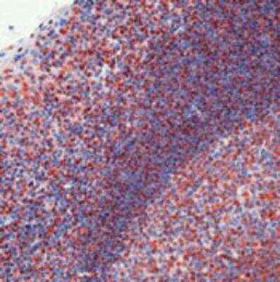 Immunohistochemistry-Paraffin: Smith Antigen Antibody (Y12) [NB600-546]