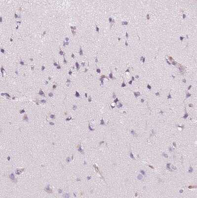Immunohistochemistry-Paraffin: Smoothelin Antibody [NBP2-37931]