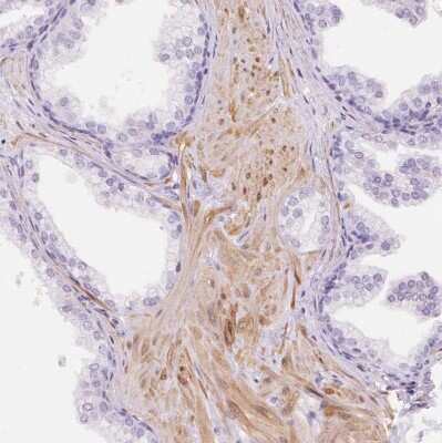Immunohistochemistry-Paraffin: Smoothelin Antibody [NBP2-37931]