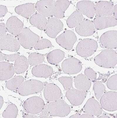 Immunohistochemistry-Paraffin: Smoothelin Antibody [NBP2-37931]