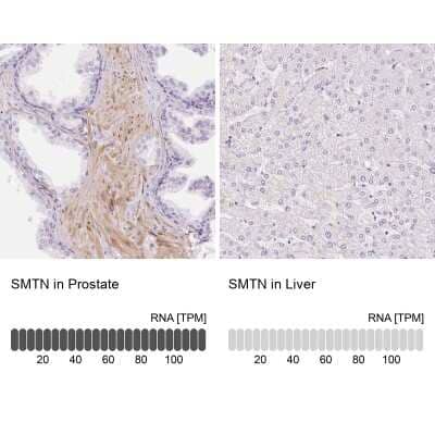 Immunohistochemistry-Paraffin: Smoothelin Antibody [NBP2-37931]