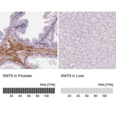 Immunohistochemistry-Paraffin: Smoothelin Antibody [NBP2-37971]