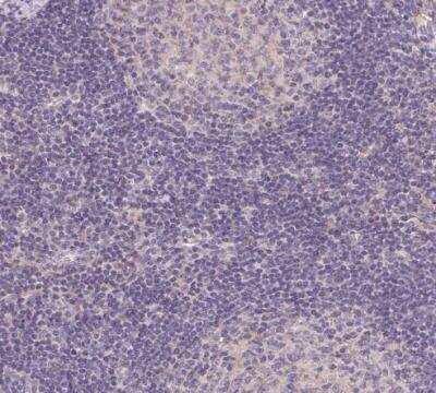 Immunohistochemistry-Paraffin: Smoothelin Antibody [NBP2-37971]