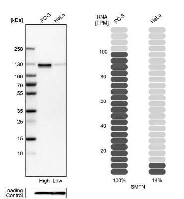 Western Blot: Smoothelin Antibody [NBP2-37931]