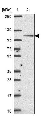 Western Blot: Smoothelin Antibody [NBP2-37971]