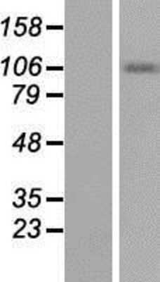 Western Blot: Smoothelin Overexpression Lysate [NBP2-05688]