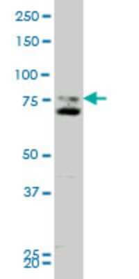 Western Blot: Smoothened Antibody (1D9) [H00006608-M11]