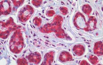 Immunohistochemistry-Paraffin: Smoothened Antibody [NBP3-06699]