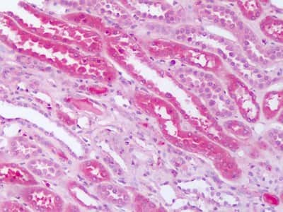 Immunohistochemistry-Paraffin: Smoothened Antibody - BSA Free [NLS2666]