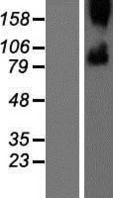 Western Blot: Smoothened Overexpression Lysate [NBP2-10451]