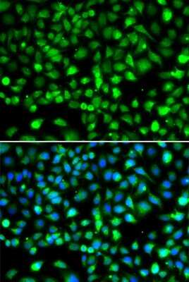 Immunocytochemistry/ Immunofluorescence: SmyD1 Antibody - BSA Free [NBP2-93805]