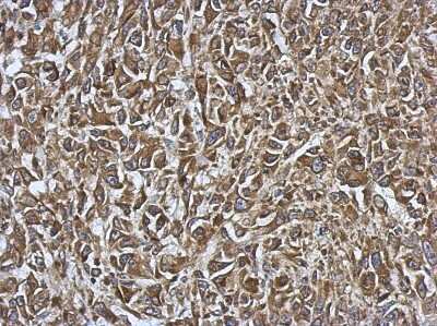 Immunohistochemistry-Paraffin: SmyD1 Antibody [NBP2-20428]