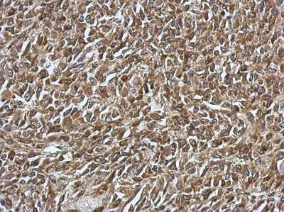 Immunohistochemistry-Paraffin: SmyD1 Antibody [NBP2-20428]