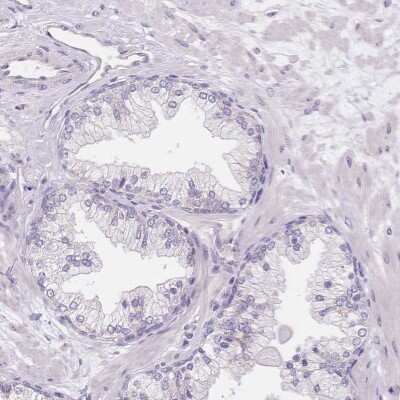 Immunohistochemistry-Paraffin: SmyD1 Antibody [NBP2-38957]