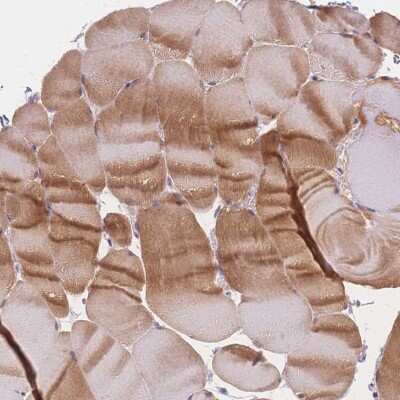 Immunohistochemistry-Paraffin: SmyD1 Antibody [NBP2-38957]