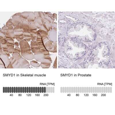 Immunohistochemistry-Paraffin: SmyD1 Antibody [NBP2-38957]