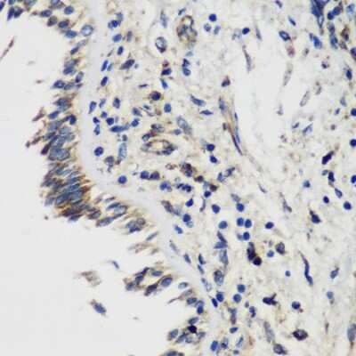 Immunohistochemistry-Paraffin: SmyD1 Antibody - BSA Free [NBP2-93805]