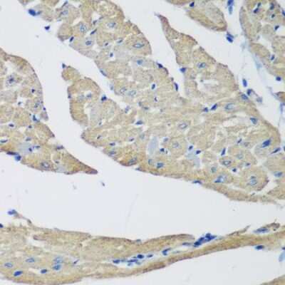 Immunohistochemistry-Paraffin: SmyD1 Antibody - BSA Free [NBP2-93805]