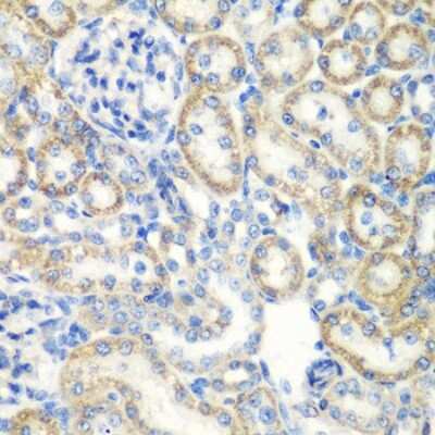 Immunohistochemistry-Paraffin: SmyD1 Antibody - BSA Free [NBP2-93805]