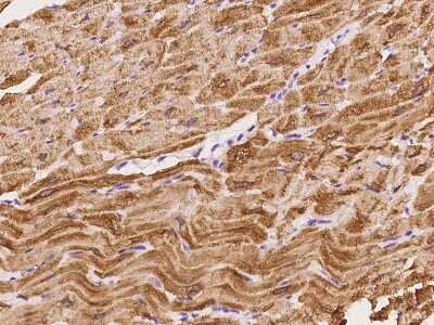 Immunohistochemistry-Paraffin: SmyD1 Antibody [NBP2-98475]