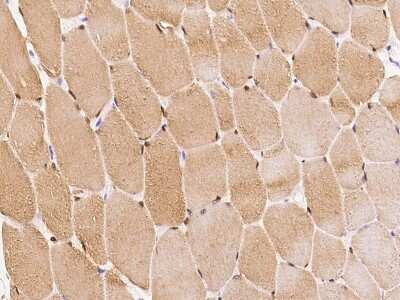 Immunohistochemistry-Paraffin: SmyD1 Antibody [NBP2-98475]