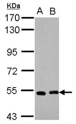 Western Blot: SmyD1 Antibody [NBP2-20428]