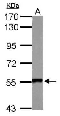 Western Blot: SmyD1 Antibody [NBP2-20428]