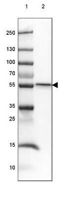 Western Blot: SmyD1 Antibody [NBP2-38957]