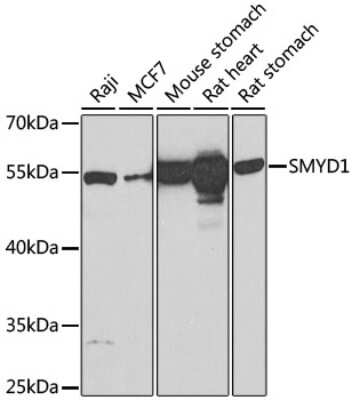 Western Blot: SmyD1 AntibodyBSA Free [NBP2-93805]