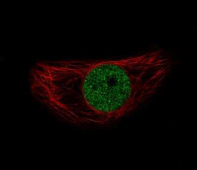 Immunocytochemistry/ Immunofluorescence: Snail Antibody (CL3700) [NBP2-61631]