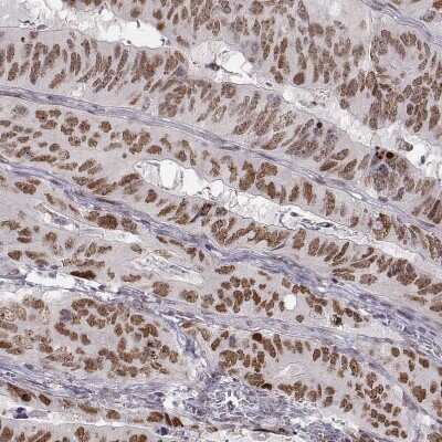 Immunohistochemistry-Paraffin: Snail Antibody (CL3700) [NBP2-61631]
