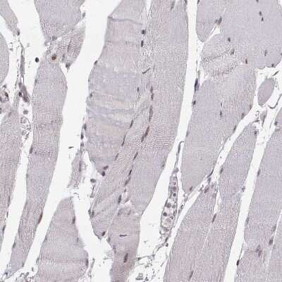 Immunohistochemistry-Paraffin: Snail Antibody (CL3700) [NBP2-61631]