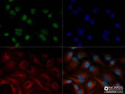 Immunocytochemistry/ Immunofluorescence: Snail Antibody [NBP2-27184]