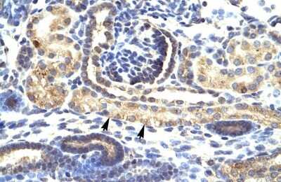 Immunohistochemistry-Paraffin: Snail Antibody [NBP1-80022]