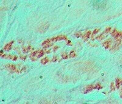 Immunohistochemistry-Paraffin: Snail Antibody - BSA Free [NBP2-27293]