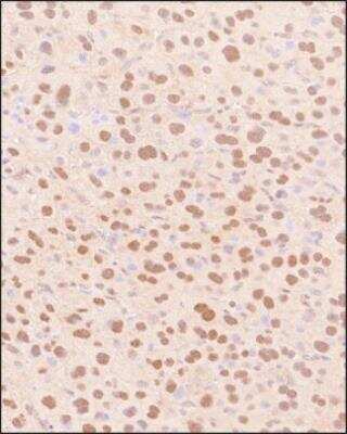 Immunohistochemistry-Paraffin: Snail Antibody - BSA Free [NBP2-27293]