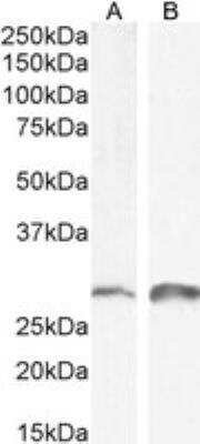 Western Blot: Snail Antibody [NB100-53787]