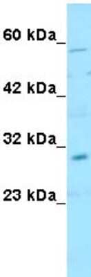 Western Blot: Snail Antibody [NBP1-80022]