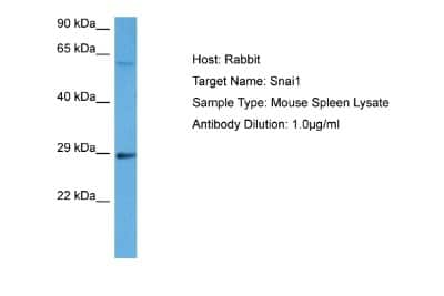 Western Blot: Snail Antibody [NBP1-80022]