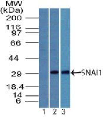 Western Blot: Snail Antibody [NBP2-27184]