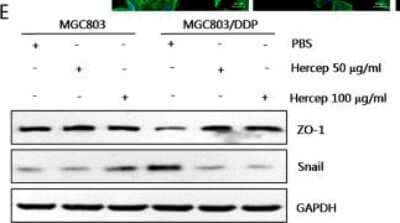 Western Blot: Snail AntibodyBSA Free [NBP2-27293]