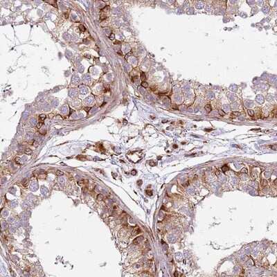 Immunohistochemistry-Paraffin: Snapin Antibody [NBP1-92414]